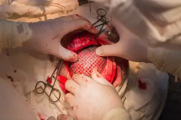 Comprehensive Support